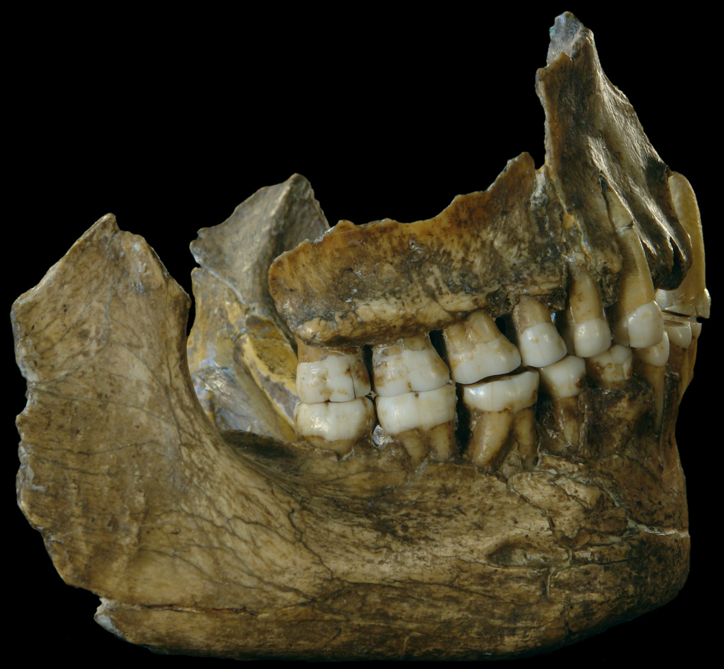 A glimpse into the life of a Neandertal from the gunk in their teeth